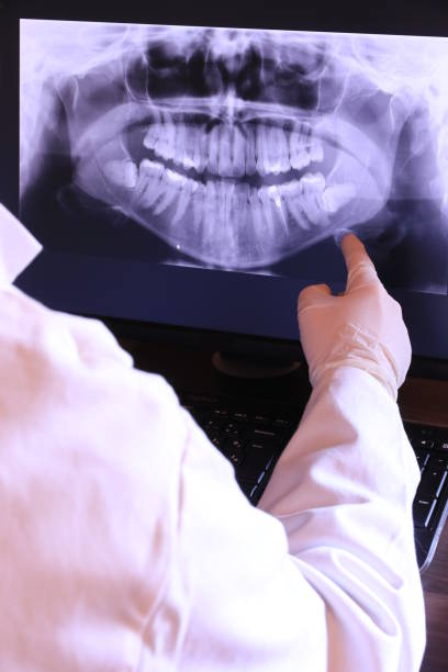 Best Emergency Dental Care for Abscessed Tooth in Portage Lakes, OH
